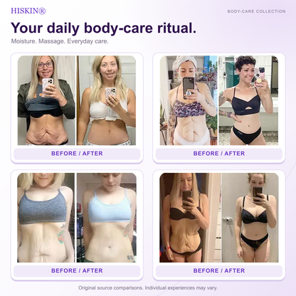 HISKIN® Official: Complete Your Order, Receive It Within 7 Days, Create Your Personalized Skin Recovery Plan — PDRN Multi-Peptide Massaging Body Roller Cream