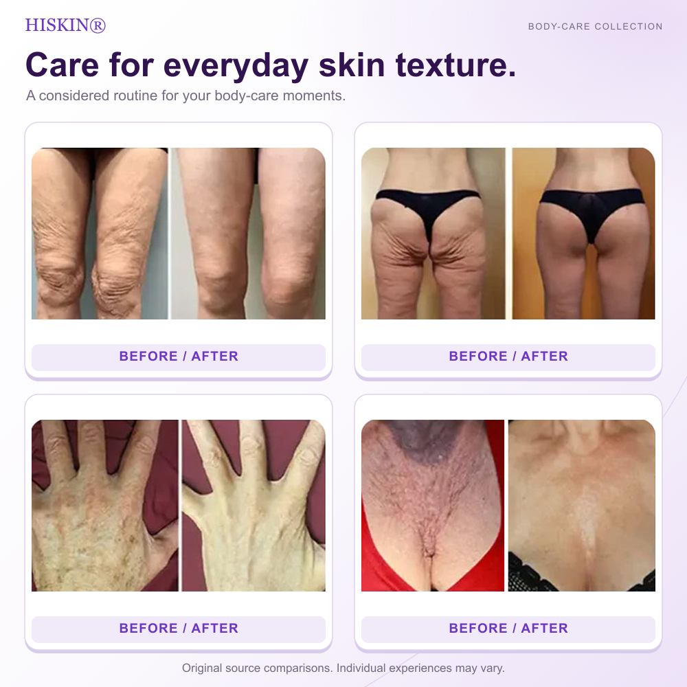 HISKIN® Official: Complete Your Order, Receive It Within 7 Days, Create Your Personalized Skin Recovery Plan — PDRN Multi-Peptide Massaging Body Roller Cream