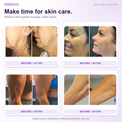 HISKIN® Official: Complete Your Order, Receive It Within 7 Days, Create Your Personalized Skin Recovery Plan — PDRN Multi-Peptide Massaging Body Roller Cream