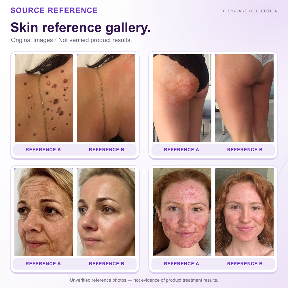 HISKIN® Official: Complete Your Order, Receive It Within 7 Days, Create Your Personalized Skin Recovery Plan — PDRN Multi-Peptide Massaging Body Roller Cream
