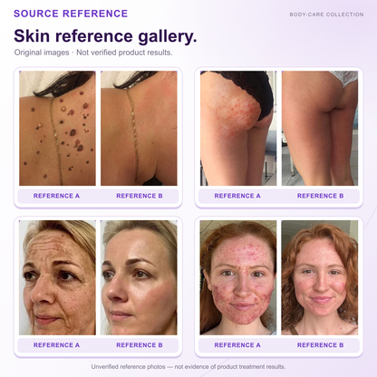 HISKIN® Official: Complete Your Order, Receive It Within 7 Days, Create Your Personalized Skin Recovery Plan — PDRN Multi-Peptide Massaging Body Roller Cream