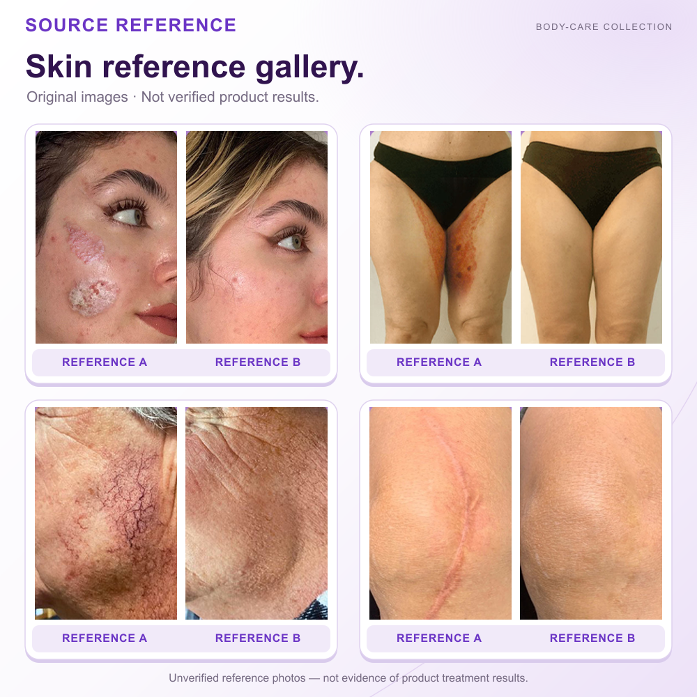HISKIN® Official: Complete Your Order, Receive It Within 7 Days, Create Your Personalized Skin Recovery Plan — PDRN Multi-Peptide Massaging Body Roller Cream