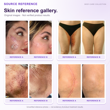 HISKIN® Official: Complete Your Order, Receive It Within 7 Days, Create Your Personalized Skin Recovery Plan — PDRN Multi-Peptide Massaging Body Roller Cream